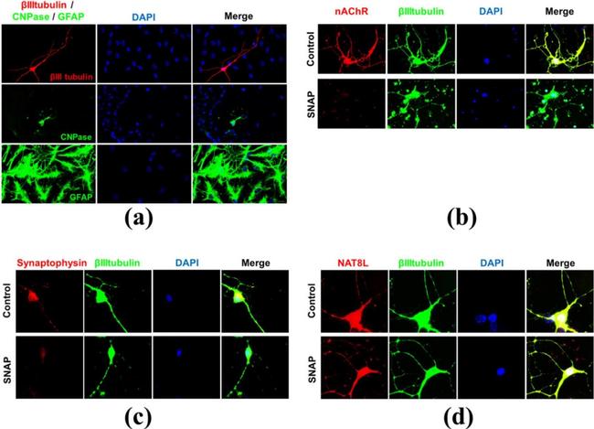 Rabbit IgG (H+L) Cross-Adsorbed Secondary Antibody in Immunocytochemistry (ICC/IF)