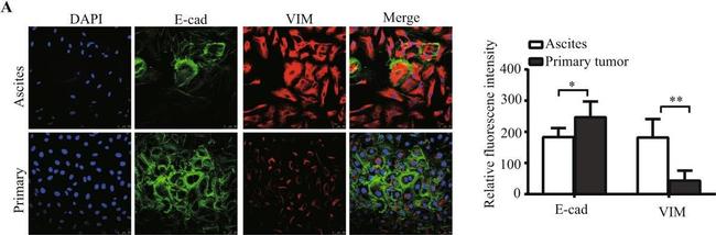 Mouse IgG1 Cross-Adsorbed Secondary Antibody in Immunocytochemistry (ICC/IF)