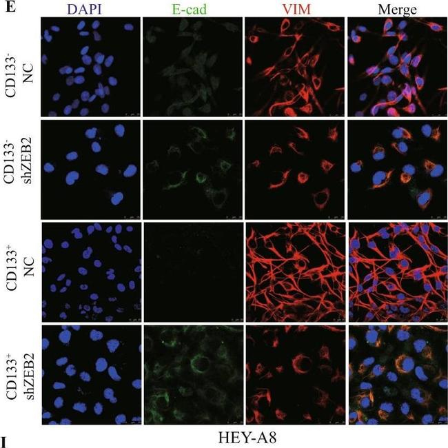 Mouse IgG1 Cross-Adsorbed Secondary Antibody in Immunocytochemistry (ICC/IF)