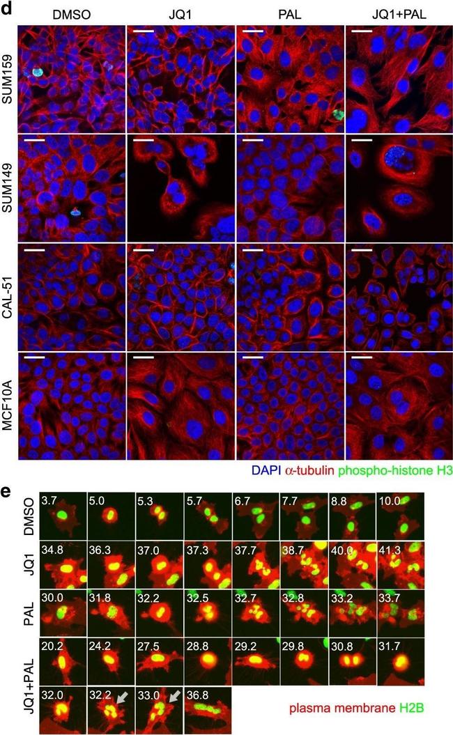 Mouse IgG1 Cross-Adsorbed Secondary Antibody in Immunocytochemistry (ICC/IF)