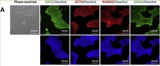 Mouse IgG (H+L) Highly Cross-Adsorbed Secondary Antibody in Immunocytochemistry (ICC/IF)