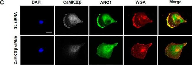 Mouse IgG (H+L) Highly Cross-Adsorbed Secondary Antibody in Immunocytochemistry (ICC/IF)