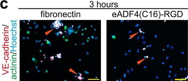 Mouse IgG (H+L) Highly Cross-Adsorbed Secondary Antibody in Immunocytochemistry (ICC/IF)