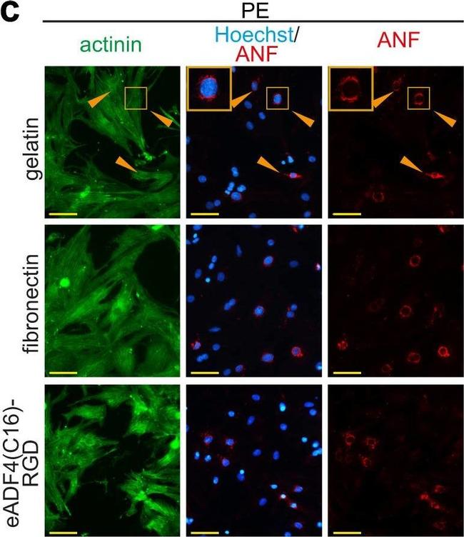 Mouse IgG (H+L) Highly Cross-Adsorbed Secondary Antibody in Immunocytochemistry (ICC/IF)