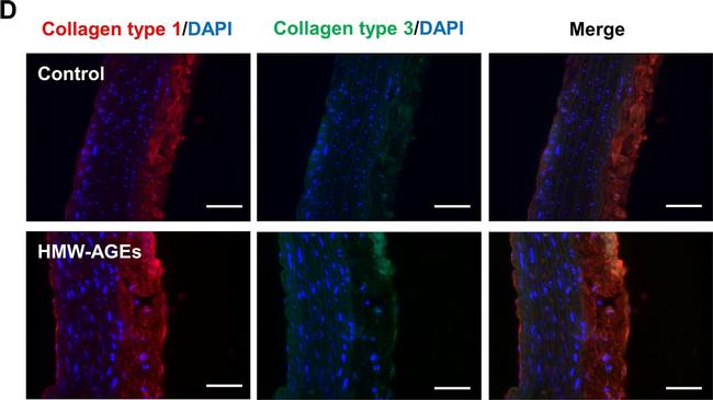 Rabbit IgG (H+L) Cross-Adsorbed Secondary Antibody in Immunohistochemistry (IHC)