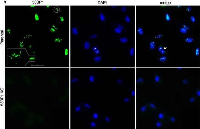 Rabbit IgG (H+L) Highly Cross-Adsorbed Secondary Antibody in Immunocytochemistry (ICC/IF)