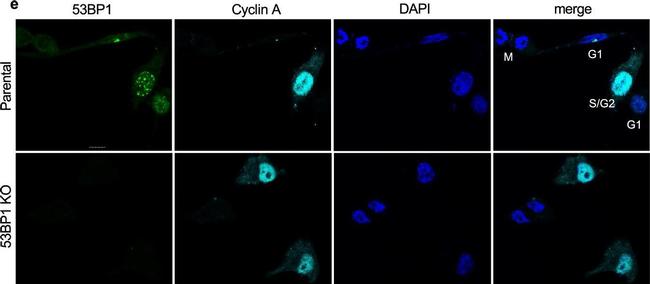 Mouse IgG (H+L) Highly Cross-Adsorbed Secondary Antibody in Immunocytochemistry (ICC/IF)