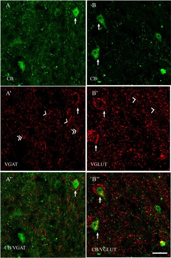 Mouse IgG (H+L) Highly Cross-Adsorbed Secondary Antibody in Immunohistochemistry (IHC)