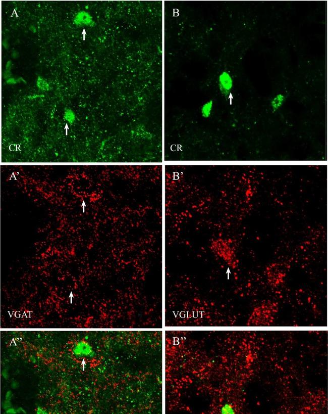 Mouse IgG (H+L) Highly Cross-Adsorbed Secondary Antibody in Immunohistochemistry (IHC)