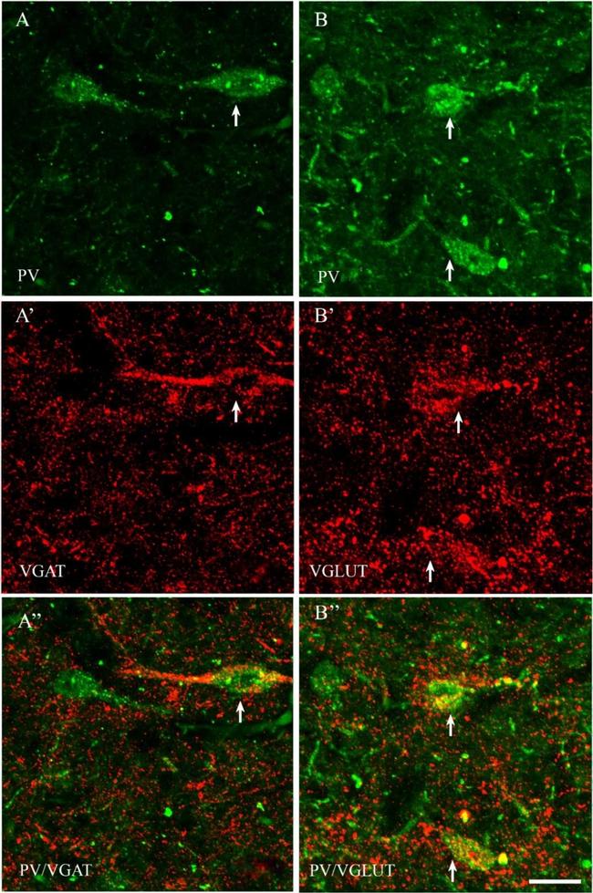 Mouse IgG (H+L) Highly Cross-Adsorbed Secondary Antibody in Immunohistochemistry (IHC)