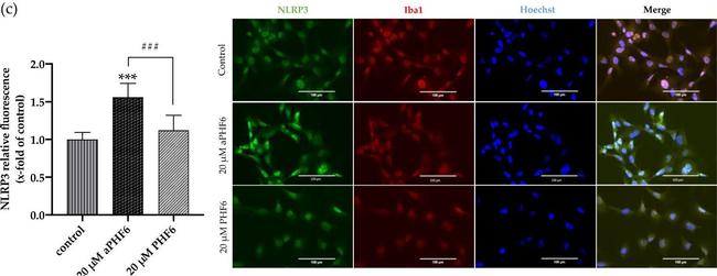 Rabbit IgG (H+L) Highly Cross-Adsorbed Secondary Antibody in Immunocytochemistry (ICC/IF)