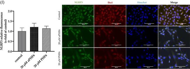 Rabbit IgG (H+L) Highly Cross-Adsorbed Secondary Antibody in Immunocytochemistry (ICC/IF)