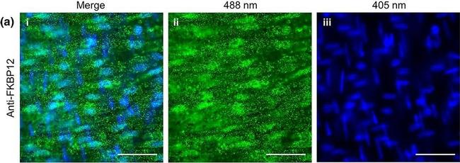 Rabbit IgG (H+L) Highly Cross-Adsorbed Secondary Antibody in Immunocytochemistry (ICC/IF)