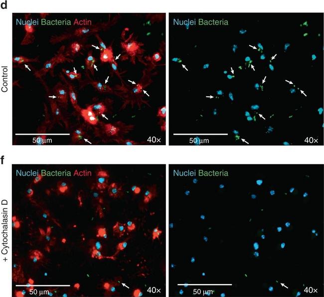 Rabbit IgG (H+L) Highly Cross-Adsorbed Secondary Antibody in Immunocytochemistry (ICC/IF)