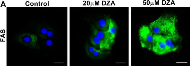 Rabbit IgG (H+L) Highly Cross-Adsorbed Secondary Antibody in Immunocytochemistry (ICC/IF)