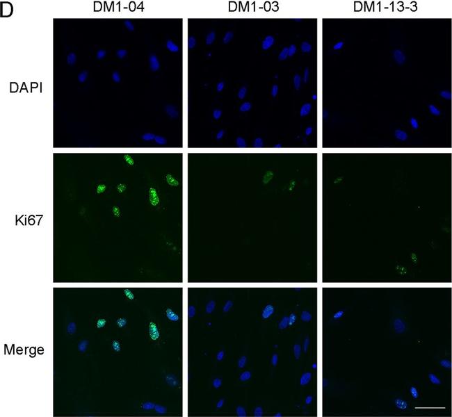 Rabbit IgG (H+L) Highly Cross-Adsorbed Secondary Antibody in Immunocytochemistry (ICC/IF)