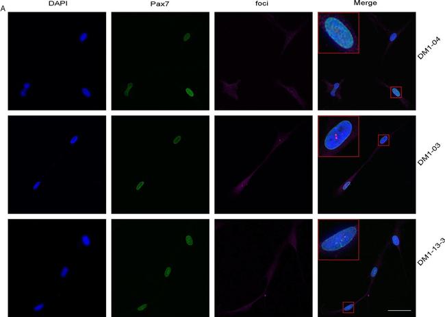 Mouse IgG (H+L) Highly Cross-Adsorbed Secondary Antibody in Immunocytochemistry (ICC/IF)