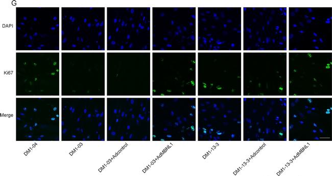 Rabbit IgG (H+L) Highly Cross-Adsorbed Secondary Antibody in Immunocytochemistry (ICC/IF)