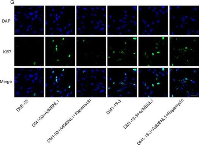 Rabbit IgG (H+L) Highly Cross-Adsorbed Secondary Antibody in Immunocytochemistry (ICC/IF)