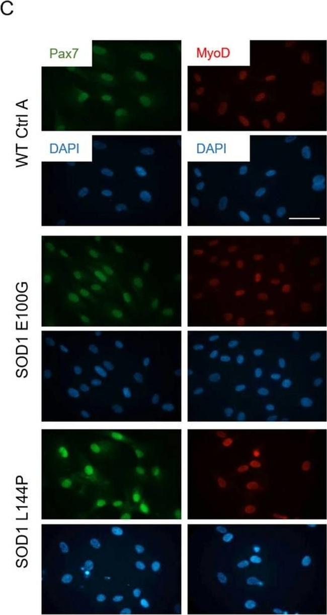 Rabbit IgG (H+L) Highly Cross-Adsorbed Secondary Antibody in Immunocytochemistry (ICC/IF)