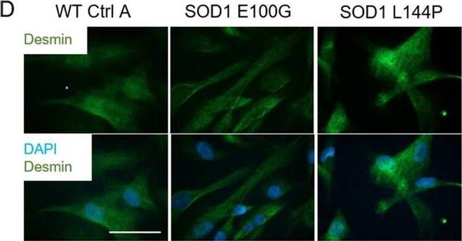 Rabbit IgG (H+L) Highly Cross-Adsorbed Secondary Antibody in Immunocytochemistry (ICC/IF)