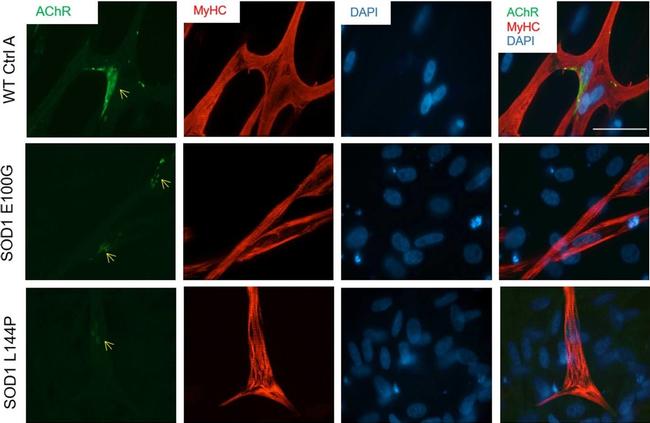 Rabbit IgG (H+L) Highly Cross-Adsorbed Secondary Antibody in Immunocytochemistry (ICC/IF)