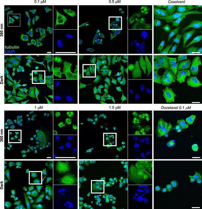 Rabbit IgG (H+L) Highly Cross-Adsorbed Secondary Antibody in Immunocytochemistry (ICC/IF)