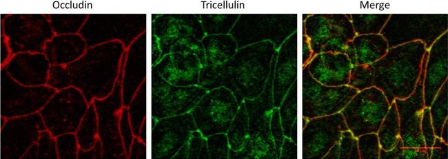 Rabbit IgG (H+L) Highly Cross-Adsorbed Secondary Antibody in Immunocytochemistry (ICC/IF)