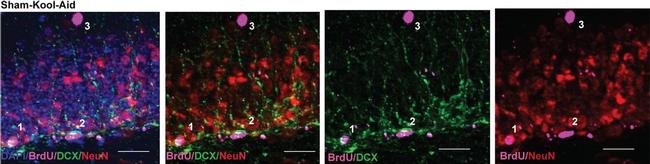 Mouse IgG (H+L) Highly Cross-Adsorbed Secondary Antibody in Immunohistochemistry (IHC)