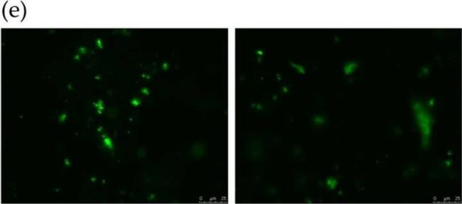 Rabbit IgG (H+L) Highly Cross-Adsorbed Secondary Antibody in Immunocytochemistry (ICC/IF)