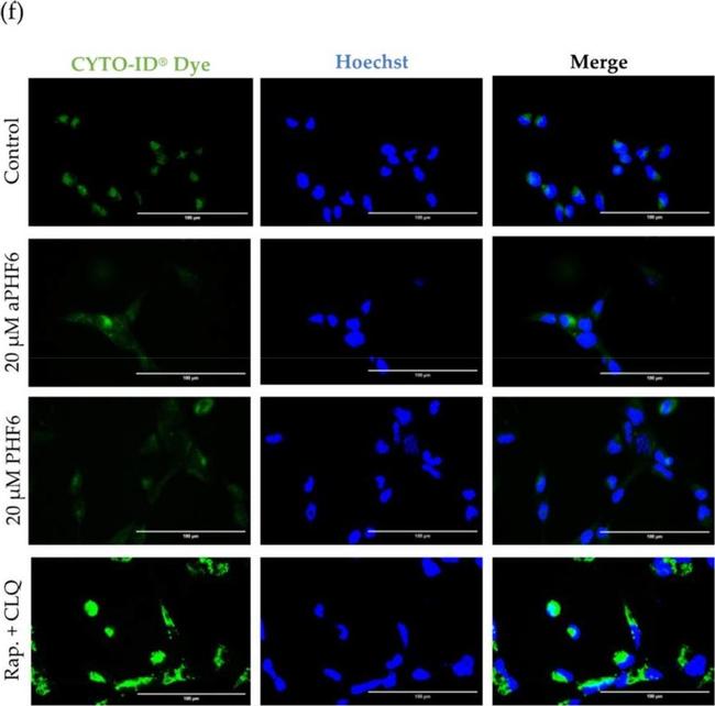 Rabbit IgG (H+L) Highly Cross-Adsorbed Secondary Antibody in Immunocytochemistry (ICC/IF)