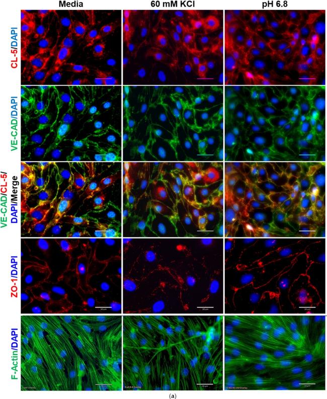 Rabbit IgG (H+L) Highly Cross-Adsorbed Secondary Antibody in Immunocytochemistry (ICC/IF)