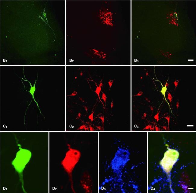 Guinea Pig IgG (H+L) Highly Cross-Adsorbed Secondary Antibody in Immunohistochemistry (PFA fixed) (IHC (PFA))