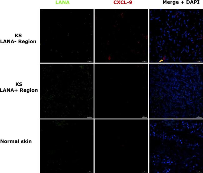 Rat IgG (H+L) Highly Cross-Adsorbed Secondary Antibody in Immunohistochemistry (Paraffin) (IHC (P))