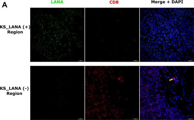 Rat IgG (H+L) Highly Cross-Adsorbed Secondary Antibody in Immunohistochemistry (Paraffin) (IHC (P))