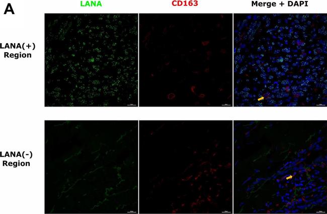 Rat IgG (H+L) Highly Cross-Adsorbed Secondary Antibody in Immunohistochemistry (Paraffin) (IHC (P))