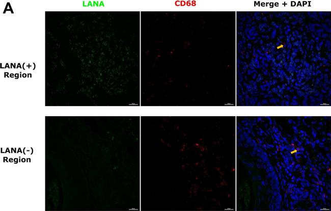 Rat IgG (H+L) Highly Cross-Adsorbed Secondary Antibody in Immunohistochemistry (Paraffin) (IHC (P))