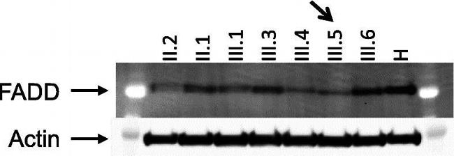 Mouse IgG (H+L) Highly Cross-Adsorbed Secondary Antibody in Western Blot (WB)