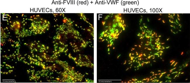 Mouse IgG (H+L) Cross-Adsorbed Secondary Antibody in Immunocytochemistry (ICC/IF)