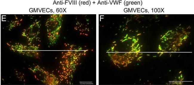 Mouse IgG (H+L) Cross-Adsorbed Secondary Antibody in Immunocytochemistry (ICC/IF)