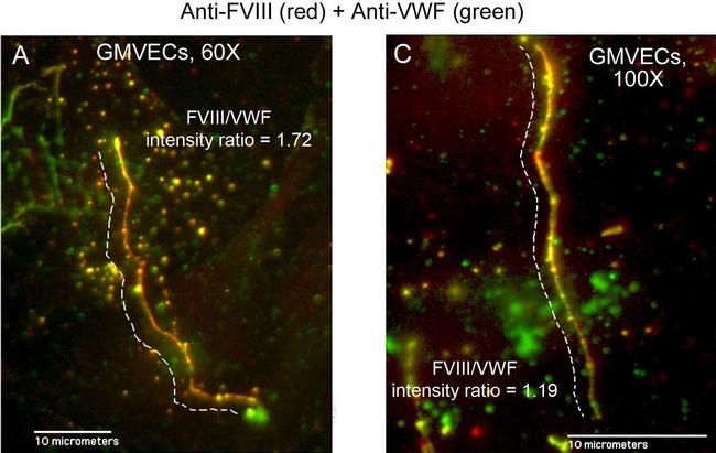 Mouse IgG (H+L) Cross-Adsorbed Secondary Antibody in Immunocytochemistry (ICC/IF)