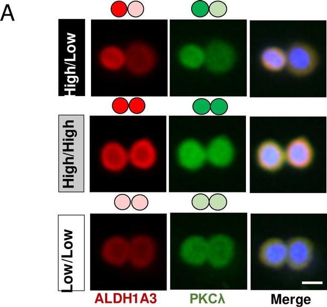 Rabbit IgG (H+L) Highly Cross-Adsorbed Secondary Antibody in Immunocytochemistry (ICC/IF)