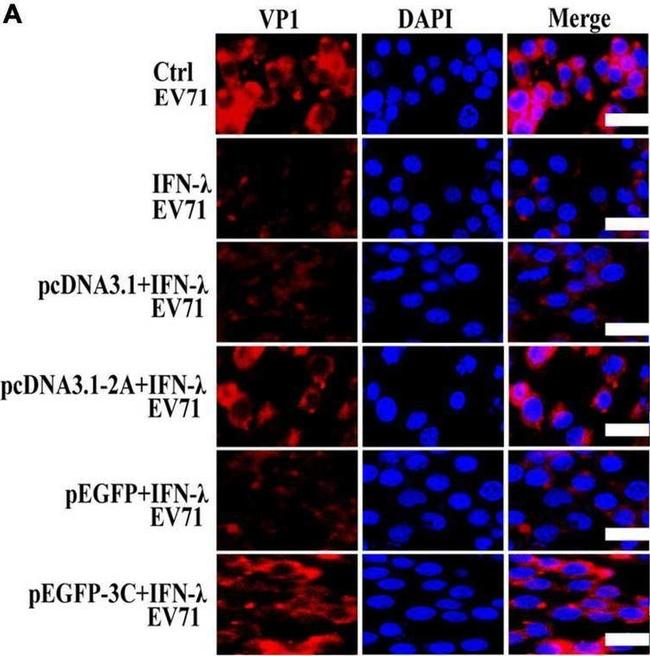 Rabbit IgG (H+L) Highly Cross-Adsorbed Secondary Antibody in Immunocytochemistry (ICC/IF)