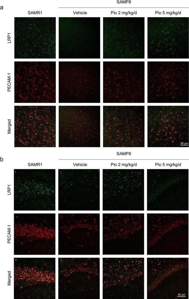 Rabbit IgG (H+L) Cross-Adsorbed Secondary Antibody in Immunohistochemistry (Paraffin) (IHC (P))