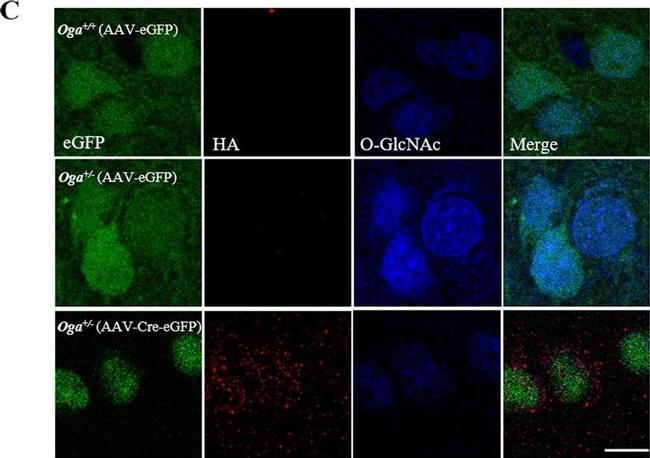 Mouse IgG (H+L) Cross-Adsorbed Secondary Antibody in Immunohistochemistry (IHC)