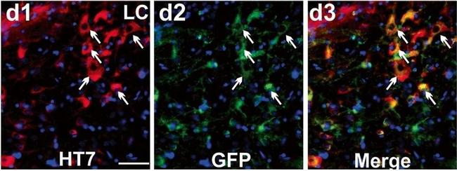 Rabbit IgG (Heavy chain) Secondary Antibody in Immunohistochemistry (IHC)