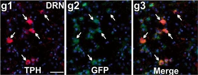 Rabbit IgG (Heavy chain) Secondary Antibody in Immunocytochemistry (ICC/IF)