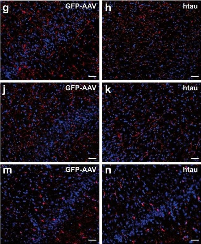 Mouse IgG (H+L) Highly Cross-Adsorbed Secondary Antibody in Immunohistochemistry (IHC)