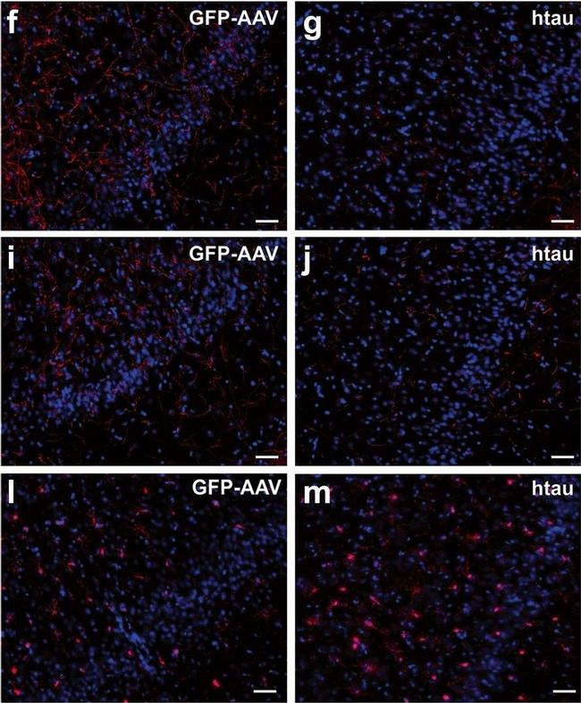 Mouse IgG (H+L) Highly Cross-Adsorbed Secondary Antibody in Immunohistochemistry (IHC)