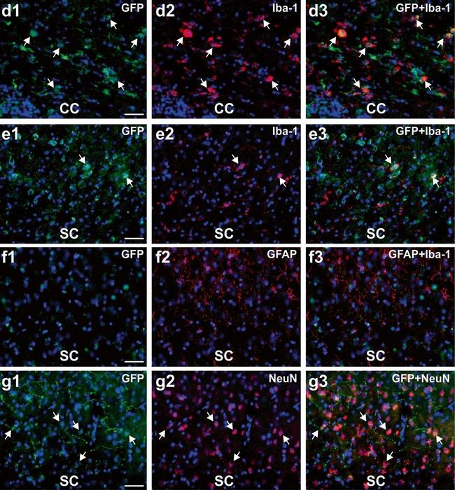 Rabbit IgG (Heavy chain) Secondary Antibody in Immunohistochemistry (IHC)